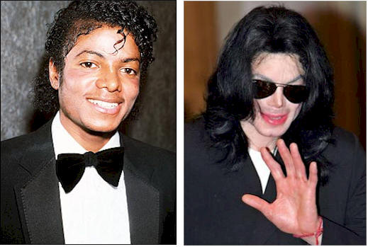 Jackson před a po